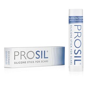 Recopilacion De Prosvent Precio Los 5 Mejores